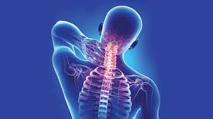 Cervical Problems