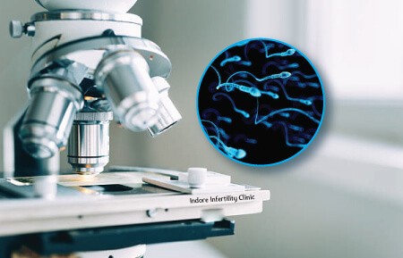 Semen Analysis