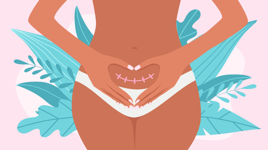 vaginal-birth-after-cesarean